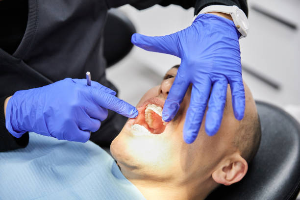 Best Dentist for Tooth Abscess  in Hudson, PA